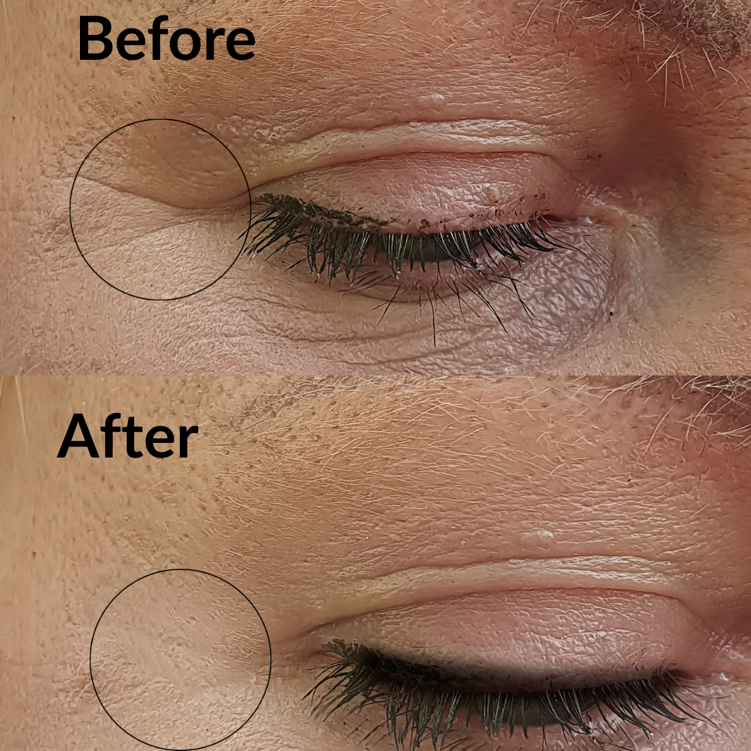 Supercharge Anti-Aging Bakuchiol Retinol Serum